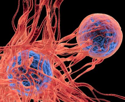 CAR-T-Cell-Therapy-in-India-Next-Gen-Cancer-Treatment-United-Biotech-India