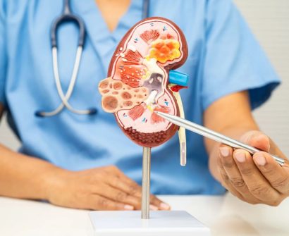 The Rising Global Burden of Kidney Disease and the Pharmaceutical Supply Chain Behind It